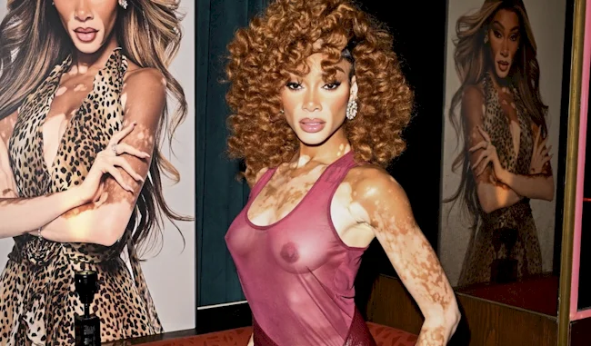 A woman with curly hair and vitiligo wears a sheer pink top and poses in front of a large poster of herself in a leopard print dress. The setting appears to be an indoor event or exhibition.