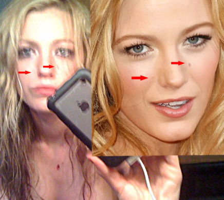Side-by-side images of a woman’s face with red arrows pointing to moles and freckles, highlighting the same spots on both images for comparison. She holds a smartphone for a selfie in one image.